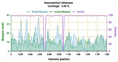 Intrapleural injection of urokinase in the treatment of acute Haemophilus influenza empyema in children: A case report and literature review